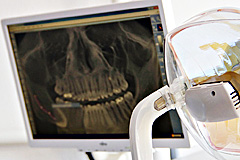 Digitales Röntgen direckt auf dem Behandlungsstuhl